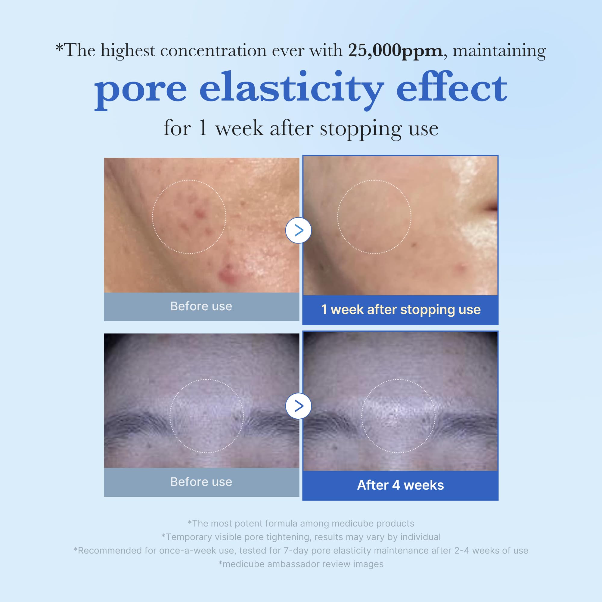 medicube Exosome Shot Zero 2,000 PPM Spicule Facial Serum | Liquid Skin Booster Serum | Exosome, AHA+BHA+PHA | Pore Care, Dead Skin Cells, Skin Texture | Korean Skincare, 1.01 fl.oz