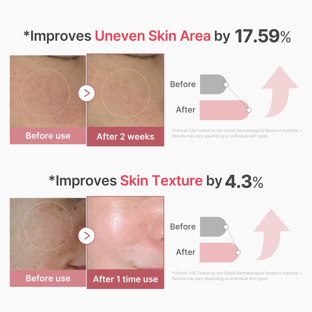 medicube Exosome Shot Zero 2,000 PPM Spicule Facial Serum | Liquid Skin Booster Serum | Exosome, AHA+BHA+PHA | Pore Care, Dead Skin Cells, Skin Texture | Korean Skincare, 1.01 fl.oz